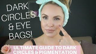 ULTIMATE GUIDE ON DARK CIRCLES, EYE BAGS, PIGMENTATION CORRECTION